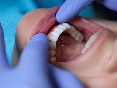 Advanced Dental Care of Las Colinas | Sports Mouthguards, Dental Cleanings and Pediatric Dentistry