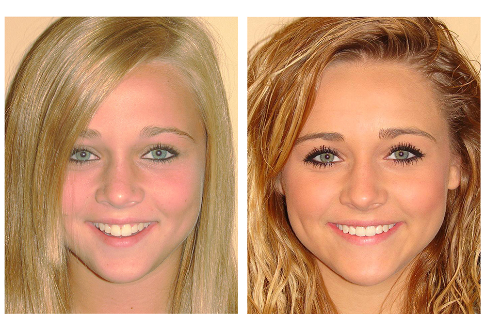 Advanced Dental Care of Las Colinas