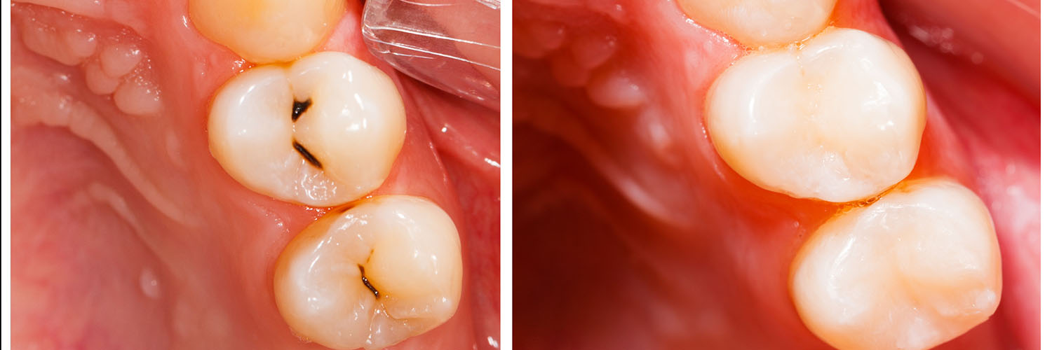 Advanced Dental Care of Las Colinas