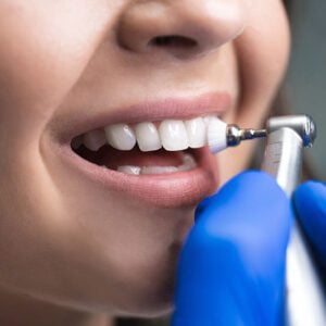 dental cleanings dentist
