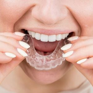 cosmetic dentist Invisalign