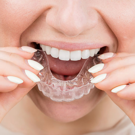 cosmetic dentist Invisalign