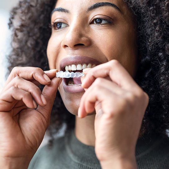 dental office near me Invisalign cosmetic dentist Irving Texas